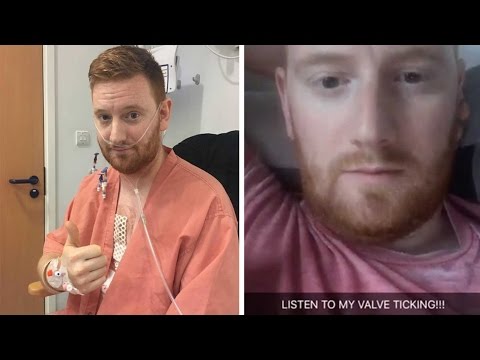 بالفيديوشاهد حالة نادرة لرجل يسمع دقات قلبه