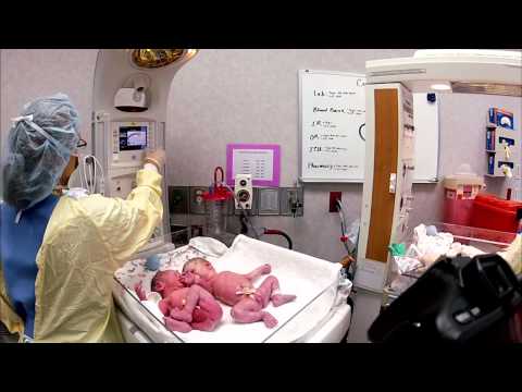 بالفيديو   7 ملايين مشاهدة لردة فعل توأم يتقابلان لأول مرة