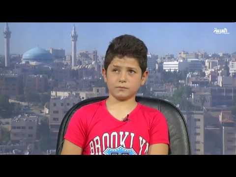 باسل محمد أحد ضحايا الحرب السورية يروي قصته