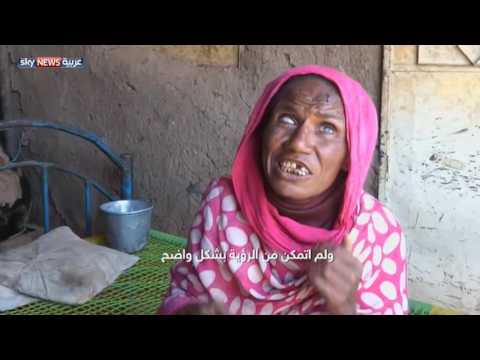 بالفيديو عائلة سودانية تصارع بؤس الفقر والأمراض دون أدنى الاحتياجات