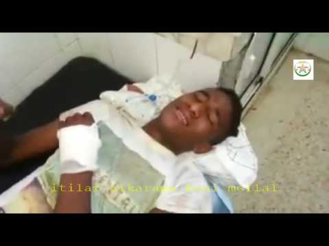 مُعاناة ضحية قرطاسة شرطي من الصقور في بني ملال