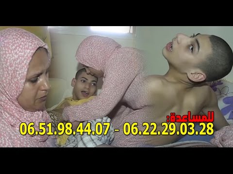 شاهد خطأ طبي منذ الولادة يحول حياة  مروان إلى جحيم