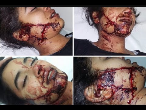 عاطل يشوّه وجه فتاة بالسكين في مدينة إنزكان