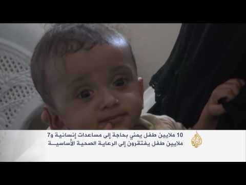 أطفال اليمن مصابون بسوء تغذية حادّ وحالتهم تجاوزت المقاييس العالميّة