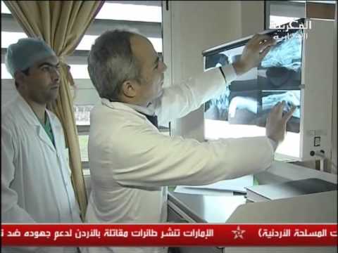 عملية جراحية ناجحة لإعادة يد مبتورة