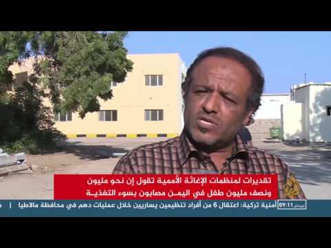 افتتاح 30 مركزًا لاستقبال حالات سوء التغذية في اليمن