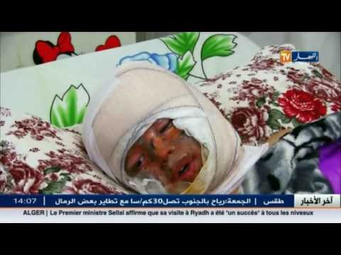 شاهد حوادث تسرب الغاز تحصد أرواح الجزائريين