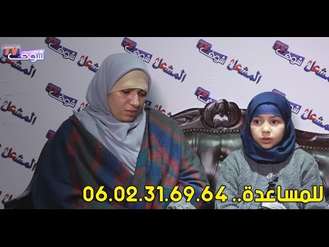 شاهد حالة نادرة في المغرب طفلة صغيرة تتبول من بطنها