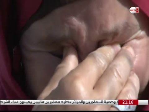 شاهد كريمة تحكي بحرقة أسباب إدمانها المخدرات