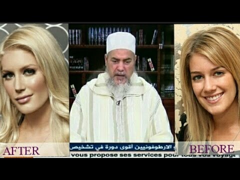 شاهد فتاة أجرت عملية تجميلة دون إخبار خطيبها