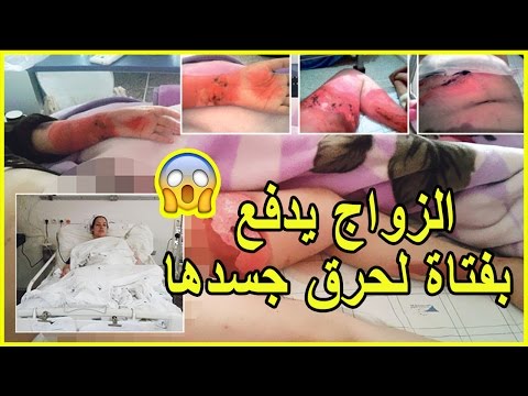 شاهد ماذا حدث لفتاة مقبلة على الزواج في الدشيرة