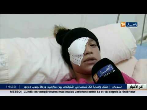 إصابة التلميذة نسرين على مستوى العين بسبب الاحتجاجات
