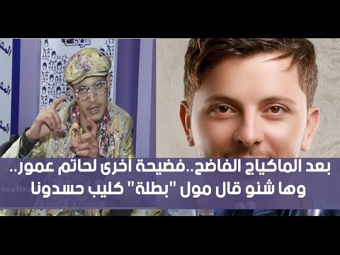 شاهد فضيحة أخرى لحاتم عمور