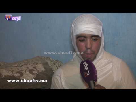 التلميذ الذي أضرم النار في جسده يكشف سبب انتحاره