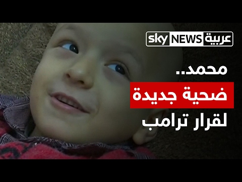 طفل أردني مريض ضحية جديدة لقرار الرئيس ترامب
