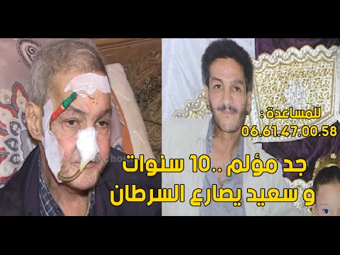 شاهد حالة خاصة ومؤلمة لشخص مريض بالسرطان1