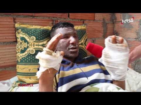 شاهد ضحايا محرقة عين عودة يروون ما وقع لهم