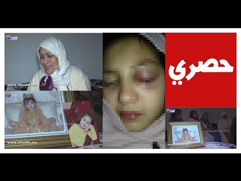 أول خروج إعلامي لوالدة الطفلة هبة