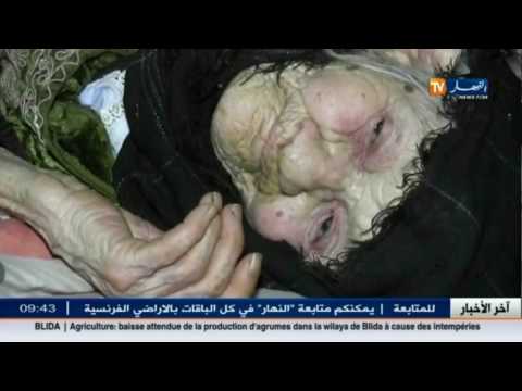 شاهد خالتي ربعية معمّرة لا تجد ما تأكله