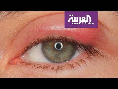 بالفيديو مشاركة الماسكارا وقلم الكحل خطر على صحة العين