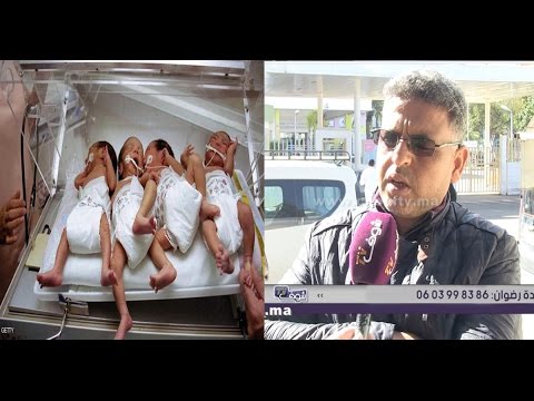 شاهد رجل يروي قصة زوجته عقب ولادتها 4 أطفال