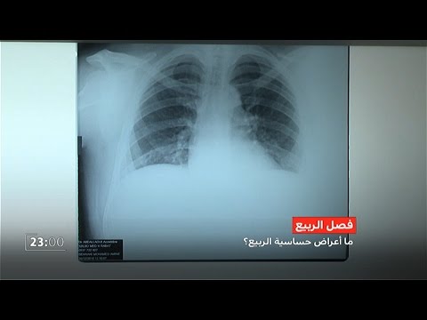 ما أعراض حساسية فصل الربيع وكيف يمكن الوقاية والعلاج