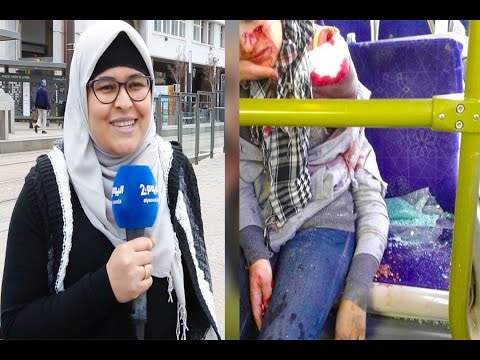 شاهد إيمان تواجه رعبها بسبب بتر يدها
