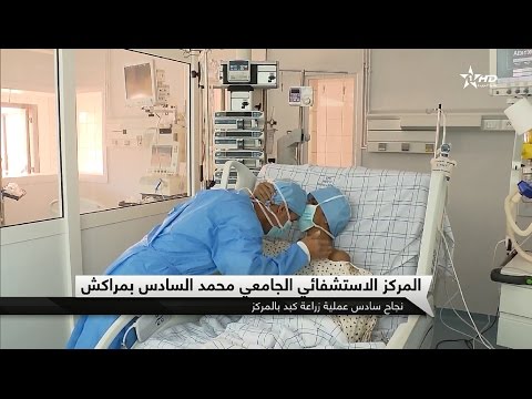 شاهد شاب يتبرع بجزء من كبده لإنقاذ حياة شقيقه في مراكش