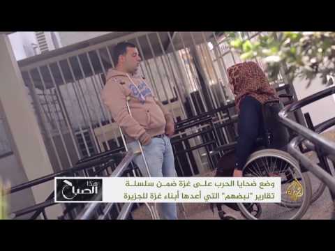 شاهد وضع ضحايا الحرب على غزة
