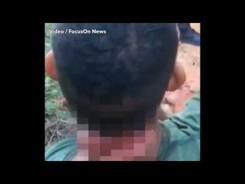 شاهد مراهق يسند رقبته بيده بعد قطع جزء منها