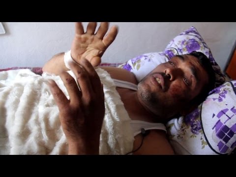 حسن ينجو من الغازات السامة في خان شيخون