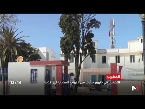 الاشتباه في ظهور حالات لمرض إلتهاب السحايا في طنجة