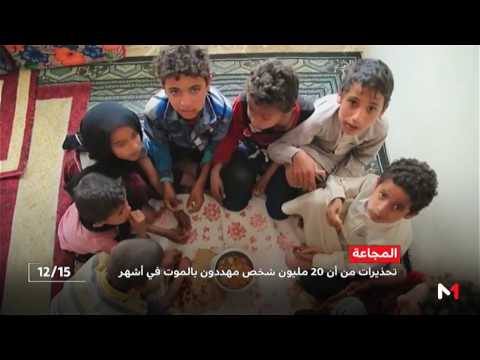 20 مليون شخص معرضون لخطر الموت جوعًا