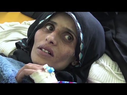 مستشفيات اليمن تخوض معركة خاسرة في مواجهة الكوليرا