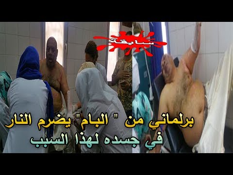 شاهد برلماني مغربي من حزب البام يشعل النار في جسده