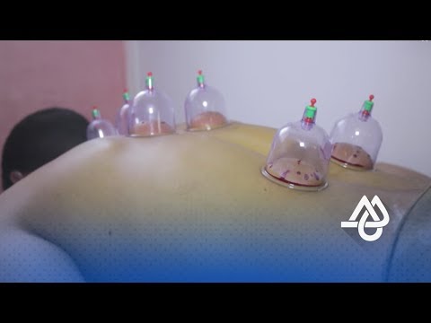 تعرف على أهم فوائد الحجامة في المغرب