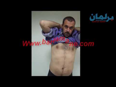 شاهد أول ظهور لناصر الزفزافي يكذب كل ما تمّ نشره