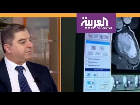 شاهد أسباب الشيب المبكر وعلاقتها أمراض القلب