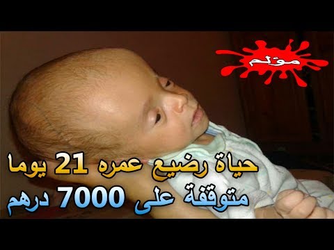 شاهد حياة طفل رضيع متوقفة على 7 آلاف درهم