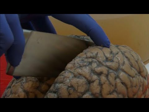 3000 عقل بشري تحت تصرف المختصين في بلجيكا