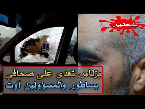 رجل يعتدي على صحافي بالساطور