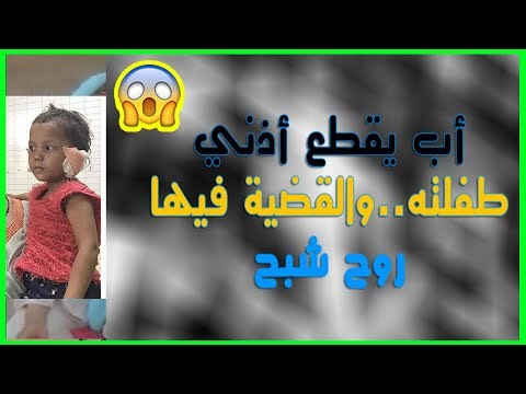 شاهد أب يقطع أذن ابنته الرضيعة دون رحمة