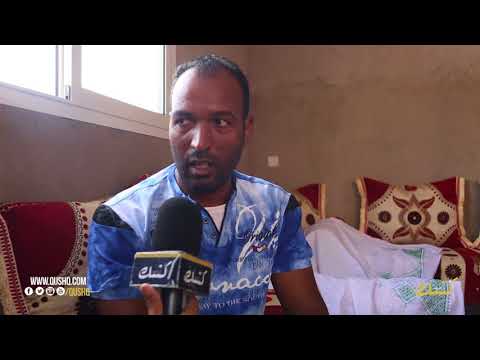 شاهد طفلة عمرها 3 أشهر تعاني من ماء في الرأس