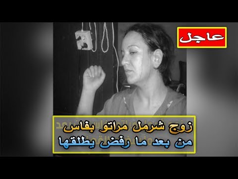 شاهد رجل يضرب زوجته بفأس ورفض أن يطلقها