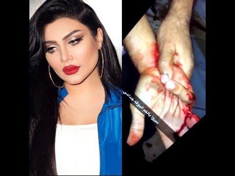 فنانة كويتية توثق لحظة سرقة سعودي في لندن بطريقة مروعة