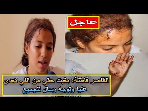 شاهد فاطمة العطراني تروي تفصيل الاعتداء عليها