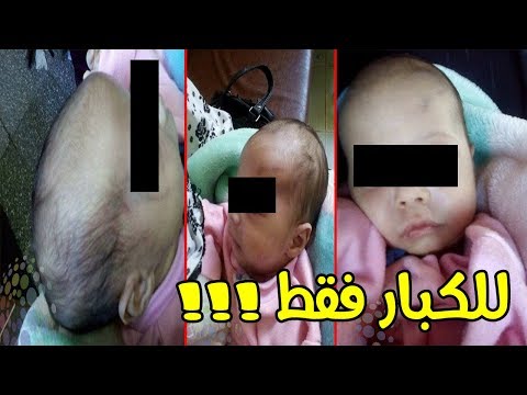 شاهد  مصري يعتدي على طفله الرضيع ويصيبه بجروح خطيرة