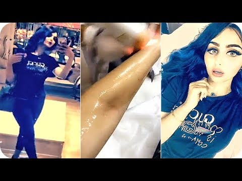 شيماء قاسم تخضع  لعملية ليزر