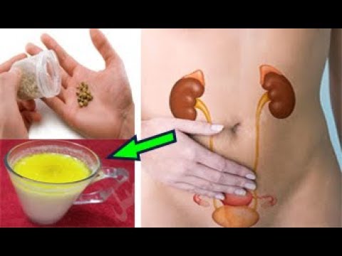 شاهد معجزة في تفتيت الحصي وعلاج حرقان البول