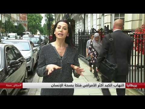 تقنية بريطانية متطورة للكشف عن تليف الكبد
